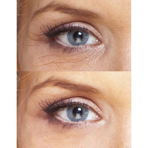 Biotic Repair Augenpflege - effektive Reduzierung von Falten, Schwellungen und Augenringen